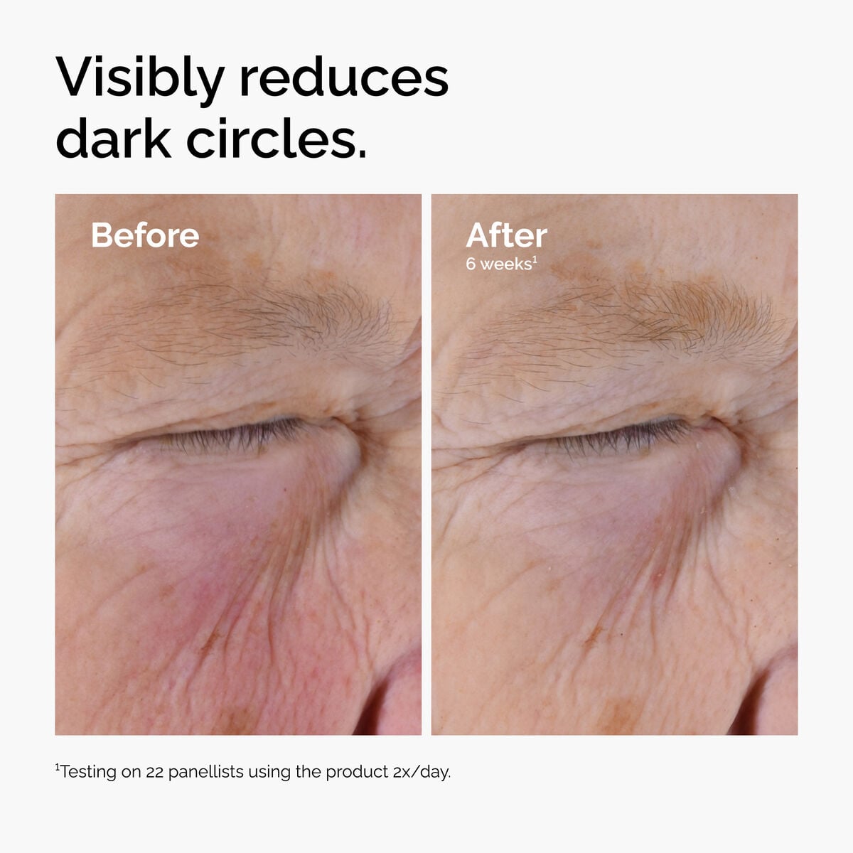 caffeine-solution-5-egcg-eye-serum-u3 ord-caffeine-solution-egcg-dark-circles-before-after.jpg