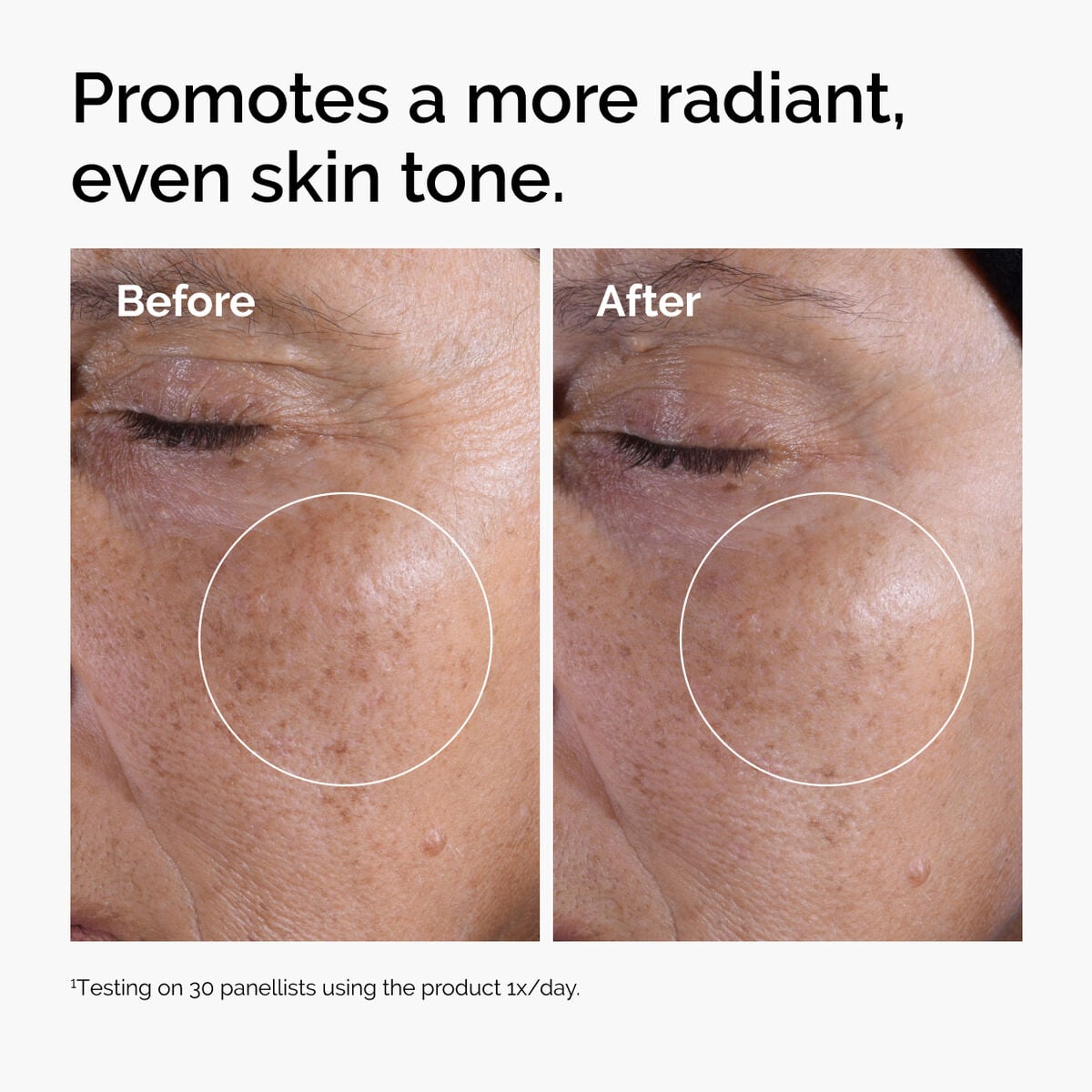 glycolic-acid-7-exfoliating-toner-z2 ord-glycolic-before-after-radiance.jpg