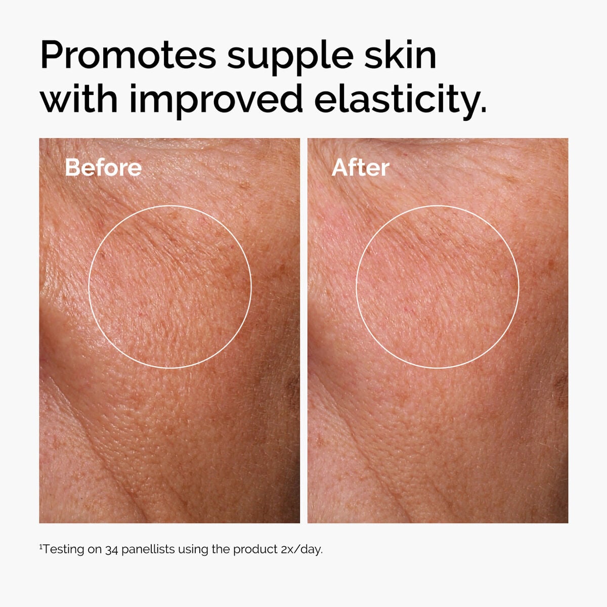hyaluronic-acid-2-b5-with-ceramides-x7 ord-hyaluronic-acid-2pct-b5-hydrating-serum-before-after-elasticity.jpg