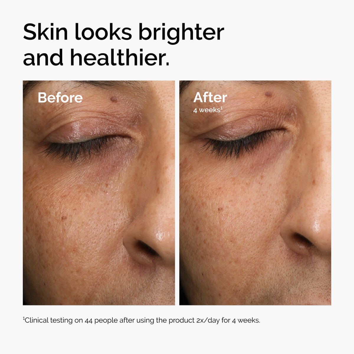 multi-antioxidant-radiance-serum-u0 ord-mars-before-after-healthy.jpg