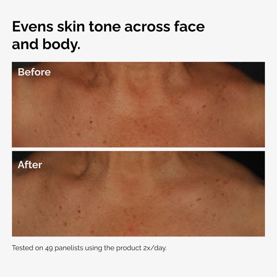 the-body-care-collection-f9 ord-niacinamide-face-body-serum-before-after-even-tone-graphic.jpg